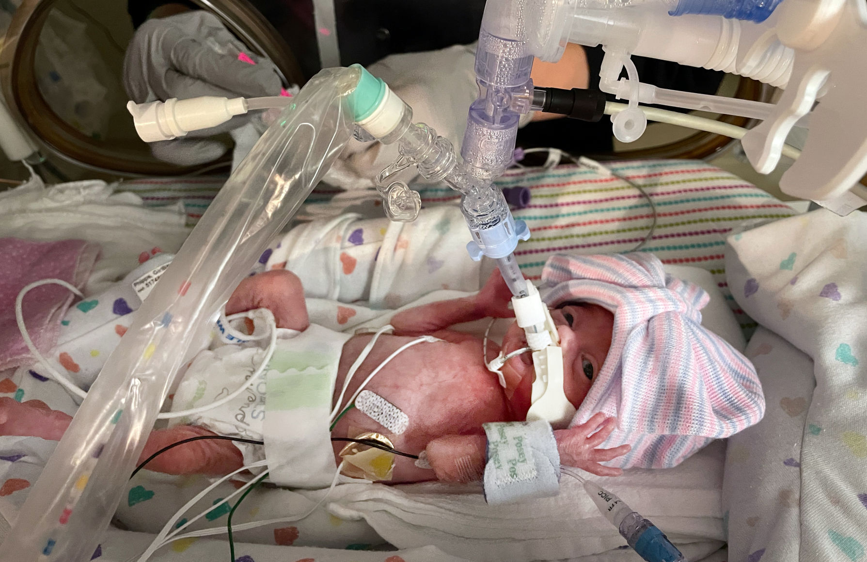 Bryan NICU